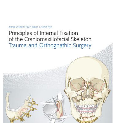 خرید و دانلود نسخه کامل کتاب Principles of Internal Fixation of the Craniomaxillofacial Skeleton: Trauma and Othognathic Surgery