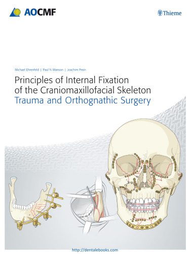 خرید و دانلود نسخه کامل کتاب Principles of Internal Fixation of the Craniomaxillofacial Skeleton: Trauma and Othognathic Surgery_68bc2a0811d13.jpeg خرید و دانلود نسخه کامل کتاب Principles of Internal Fixation of the Craniomaxillofacial Skeleton: Trauma and Othognathic Surgery