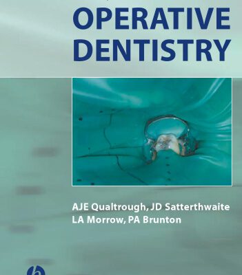 خرید و دانلود نسخه کامل کتاب Principles of Operative Dentistry