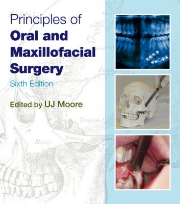 خرید و دانلود نسخه کامل کتاب Principles of Oral and Maxillofacial Surgery