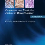 خرید و دانلود نسخه کامل کتاب Prognostic and Predictive Factors in Breast Cancer,