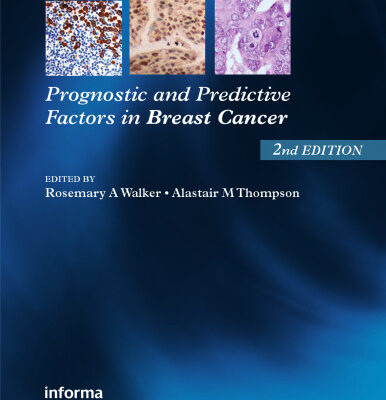 خرید و دانلود نسخه کامل کتاب Prognostic and Predictive Factors in Breast Cancer,