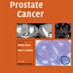 خرید و دانلود نسخه کامل کتاب Prostate Cancer (Contemporary Issues in Cancer Imaging)