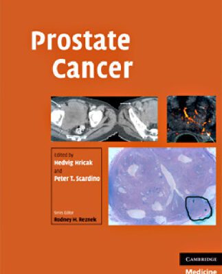 خرید و دانلود نسخه کامل کتاب Prostate Cancer (Contemporary Issues in Cancer Imaging)