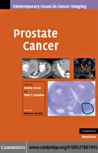 خرید و دانلود نسخه کامل کتاب Prostate Cancer (Contemporary Issues in Cancer Imaging)_68bb508f24c2d.jpeg خرید و دانلود نسخه کامل کتاب Prostate Cancer (Contemporary Issues in Cancer Imaging)