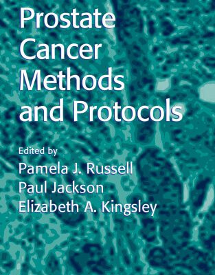 خرید و دانلود نسخه کامل کتاب Prostate Cancer Methods and Protocols (Methods in Molecular Medicine)