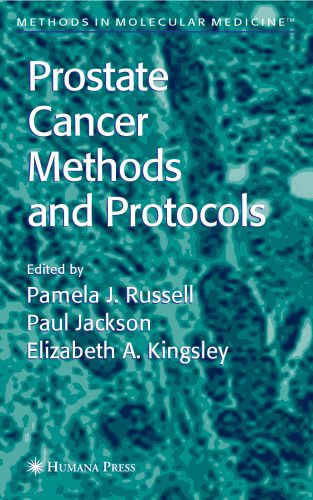 خرید و دانلود نسخه کامل کتاب Prostate Cancer Methods and Protocols (Methods in Molecular Medicine)_68bad475e3b22.jpeg خرید و دانلود نسخه کامل کتاب Prostate Cancer Methods and Protocols (Methods in Molecular Medicine)