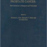 خرید و دانلود نسخه کامل کتاب Prostate Cancer New Horizons in Research and Treatment