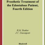خرید و دانلود نسخه کامل کتاب Prosthetic Treatment of the Edentulous Patient