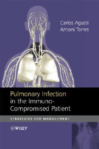 خرید و دانلود نسخه کامل کتاب Pulmonary Infection in the Immunocompromised Patient: Strategies for Management_68b583473b3f2.jpeg خرید و دانلود نسخه کامل کتاب Pulmonary Infection in the Immunocompromised Patient: Strategies for Management