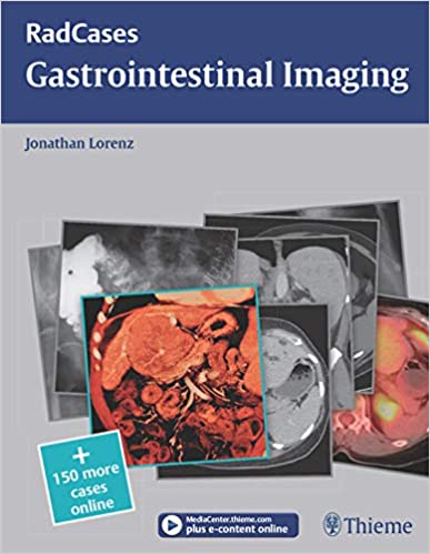 خرید و دانلود نسخه کامل کتاب Radcases Gastrointestinal Imaging (Radcases Plus Q&A) – Original PDF_68b9e7488746b.jpeg خرید و دانلود نسخه کامل کتاب Radcases Gastrointestinal Imaging (Radcases Plus Q&A) – Original PDF