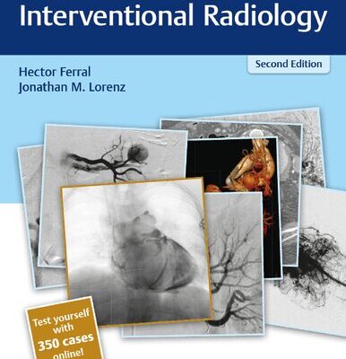 خرید و دانلود نسخه کامل کتاب Radcases Interventional Radiology