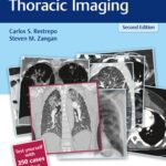 خرید و دانلود نسخه کامل کتاب RadCases Plus Q&A Thoracic Imaging