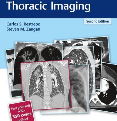 خرید و دانلود نسخه کامل کتاب RadCases Plus Q&A Thoracic Imaging