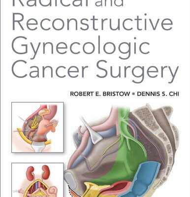 خرید و دانلود نسخه کامل کتاب Radical And Reconstructive Gynecologic Cancer Surgery