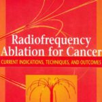 خرید و دانلود نسخه کامل کتاب Radiofrequency Ablation for Cancer Current Indications, Techniques and Outcomes