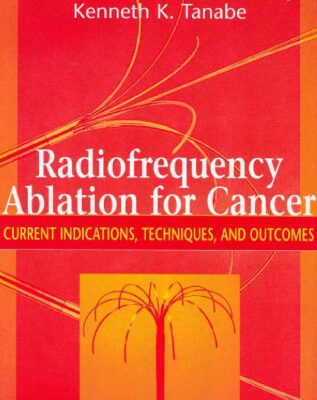 خرید و دانلود نسخه کامل کتاب Radiofrequency Ablation for Cancer Current Indications, Techniques and Outcomes