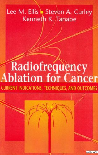 خرید و دانلود نسخه کامل کتاب Radiofrequency Ablation for Cancer Current Indications, Techniques and Outcomes_68bb54d2c796a.jpeg خرید و دانلود نسخه کامل کتاب Radiofrequency Ablation for Cancer Current Indications, Techniques and Outcomes