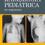 خرید و دانلود نسخه کامل کتاب Radiologia Pediatrica En Urgencias