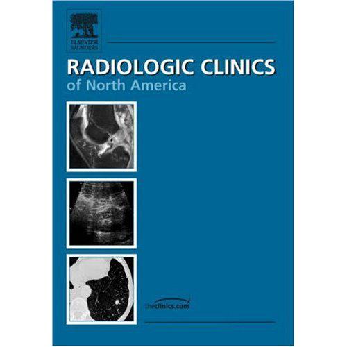خرید و دانلود نسخه کامل کتاب Radiologic Clinics Of North America Advances in Intestinal Imaging_68bad83c1107e.jpeg خرید و دانلود نسخه کامل کتاب Radiologic Clinics Of North America Advances in Intestinal Imaging