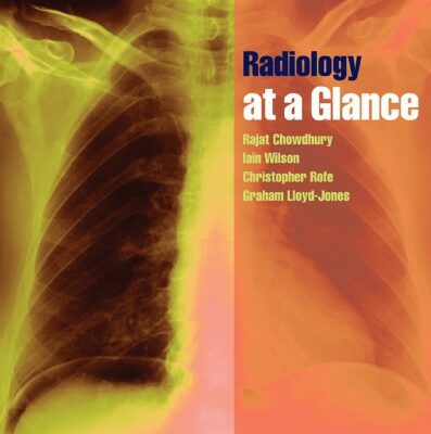 خرید و دانلود نسخه کامل کتاب Radiology at a Glance.
