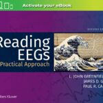 خرید و دانلود نسخه کامل کتاب Reading EEGs: A Practical Approach