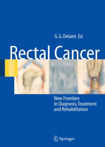 خرید و دانلود نسخه کامل کتاب Rectal Cancer-New Frontiers in Diagnosis Treatment and Rehabilitation_68bb468b6e1c0.jpeg خرید و دانلود نسخه کامل کتاب Rectal Cancer-New Frontiers in Diagnosis Treatment and Rehabilitation
