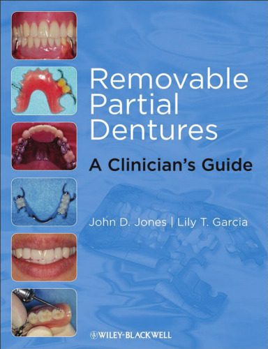 خرید و دانلود نسخه کامل کتاب Removable Partial Dentures: A Clinician’s Guide (Restorative Dentistry)_68bae393427d4.jpeg خرید و دانلود نسخه کامل کتاب Removable Partial Dentures: A Clinician’s Guide (Restorative Dentistry)