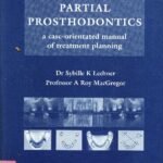 خرید و دانلود نسخه کامل کتاب Removable Partial Prosthodontics