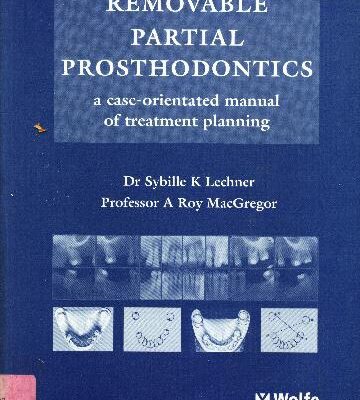 خرید و دانلود نسخه کامل کتاب Removable Partial Prosthodontics