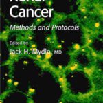 خرید و دانلود نسخه کامل کتاب Renal Cancer: Methods and Protocols (Methods in Molecular Medicine)