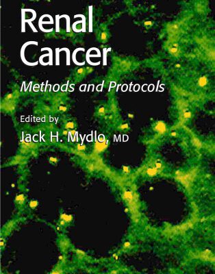 خرید و دانلود نسخه کامل کتاب Renal Cancer: Methods and Protocols (Methods in Molecular Medicine)
