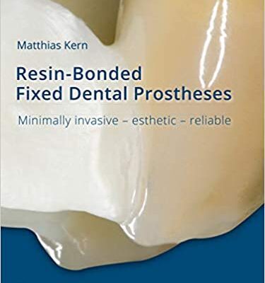 خرید و دانلود نسخه کامل کتاب Resin-Bonded Fixed Dental Prostheses: Minimally invasive – esthetic – reliable –  +  Pdf