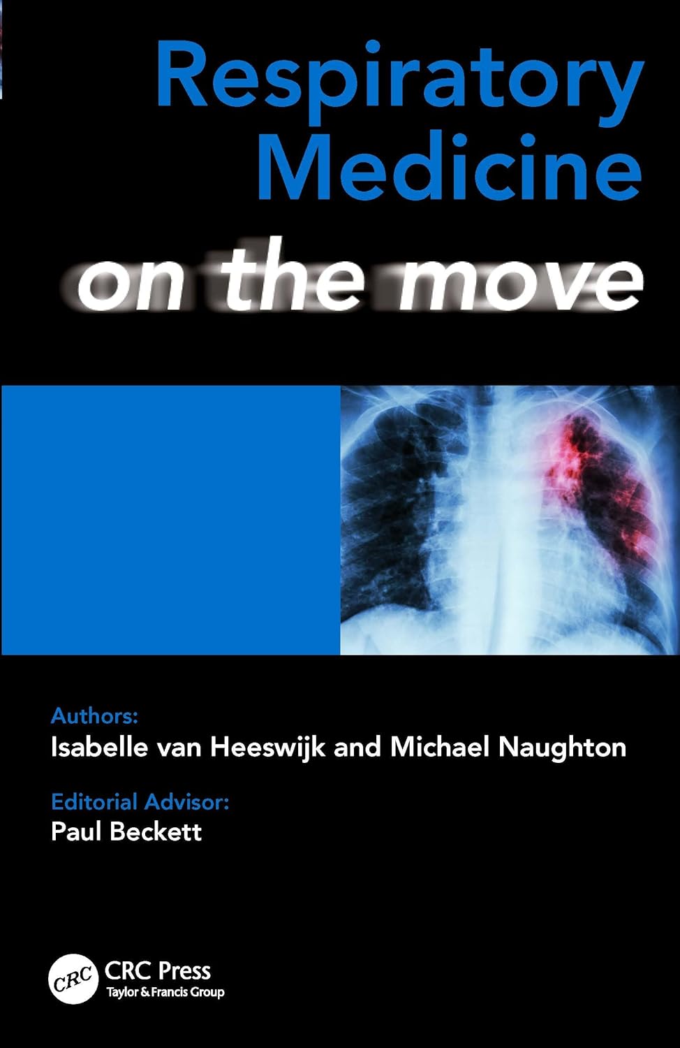 خرید و دانلود نسخه کامل کتاب Respiratory Medicine on the Move_68b5a9be07312.jpeg خرید و دانلود نسخه کامل کتاب Respiratory Medicine on the Move