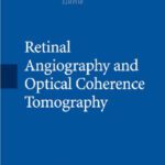 خرید و دانلود نسخه کامل کتاب Retinal Angiography and Optical Coherence Tomography