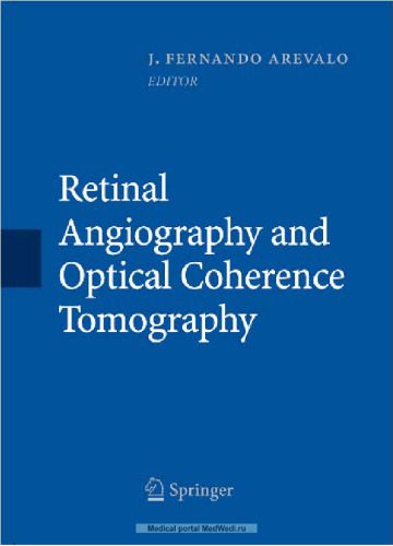 خرید و دانلود نسخه کامل کتاب Retinal Angiography and Optical Coherence Tomography_68bea00d7ca4f.jpeg خرید و دانلود نسخه کامل کتاب Retinal Angiography and Optical Coherence Tomography
