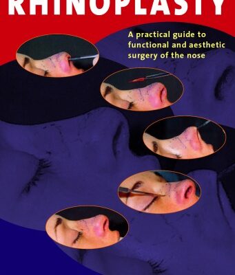 خرید و دانلود نسخه کامل کتاب Rhinoplasty: A practical guide to functional and aesthetic surgery of the nose, 3rd Edition