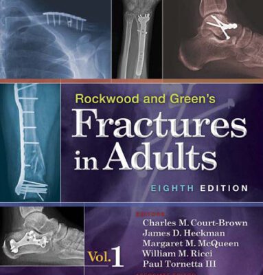 خرید و دانلود نسخه کامل کتاب Rockwood and Green’s Fractures in Adults (2 Volume Set)