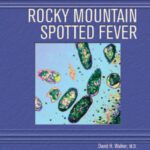 خرید و دانلود نسخه کامل کتاب Rocky Mountain Spotted Fever (Deadly Diseases and Epidemics)
