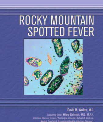 خرید و دانلود نسخه کامل کتاب Rocky Mountain Spotted Fever (Deadly Diseases and Epidemics)