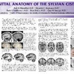 خرید و دانلود نسخه کامل کتاب SAGITTAL ANATOMY OF THE SYLVIAN CISTERN