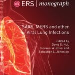 خرید و دانلود نسخه کامل کتاب SARS, MERS and other Viral Lung Infections