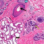 خرید و دانلود نسخه کامل کتاب Sauer’s Manual of Skin Diseases