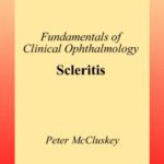 خرید و دانلود نسخه کامل کتاب Scleritis