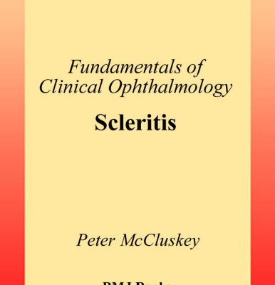 خرید و دانلود نسخه کامل کتاب Scleritis