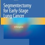 خرید و دانلود نسخه کامل کتاب Segmentectomy for Early-Stage Lung Cancer: 3D Navigation