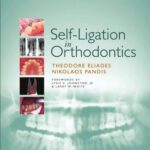خرید و دانلود نسخه کامل کتاب Self-Ligation in Orthodontics