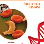 خرید و دانلود نسخه کامل کتاب Sickle Cell Disease (Genes and Disease)