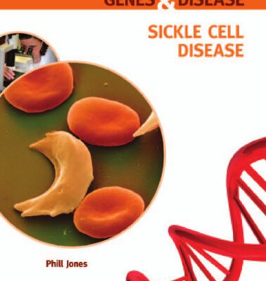 خرید و دانلود نسخه کامل کتاب Sickle Cell Disease (Genes and Disease)