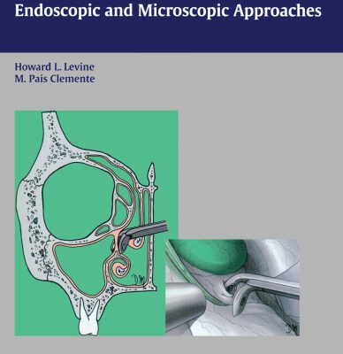 خرید و دانلود نسخه کامل کتاب Sinus Surgery: Endoscopic And Microscopic Approaches